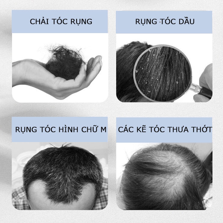 Tinh chất mọc tóc tinh dầu mọc tóc 30ml serum kích mọc tóc chăm sóc tóc chống rụng tóc,kích thích tóc mọc dà
