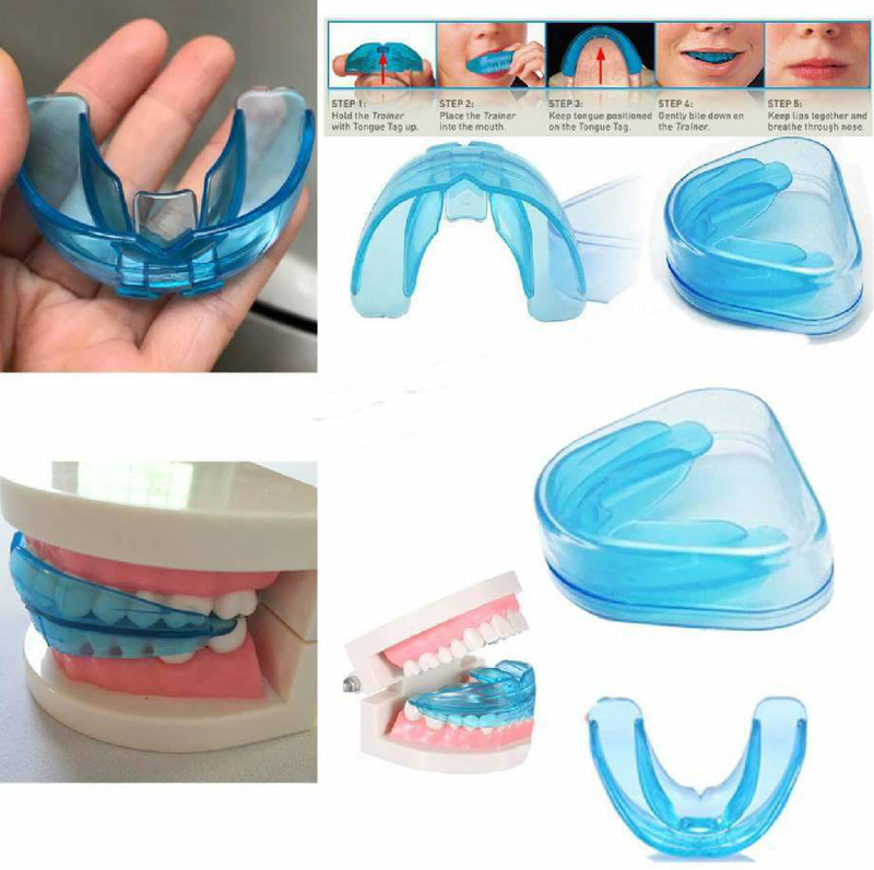 Dụng Cụ Niềng Răng Tại Nhà