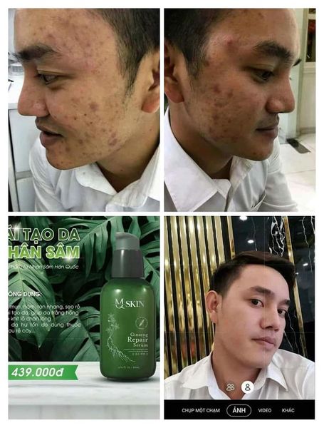 SERUM TÁI TẠO DA NHÂN SÂM MQ-SKIN ( chính hãng )