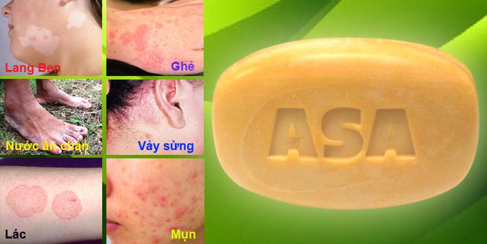 [HCM]XÀ BÔNG TẮM GHẺ NGỨA ASA