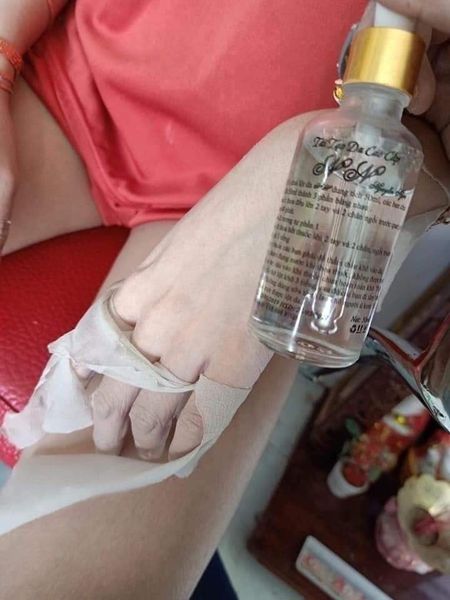 Nước Lột Da Cao Cấp Collagen