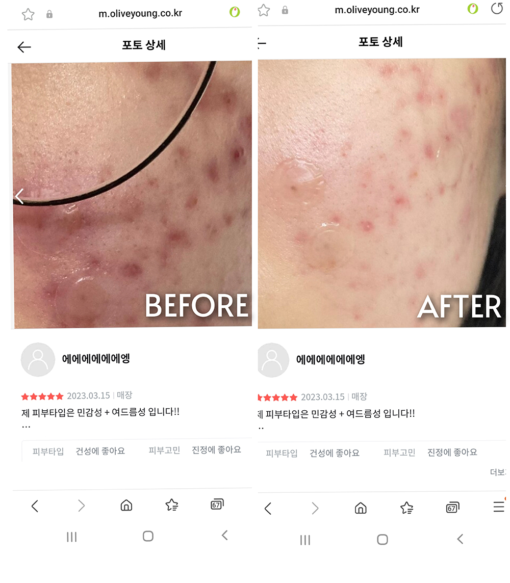 [Nhacuabeautyholic] Tinh chất, pad và toner dịu mụn ROUNDLAB PINE CALMING CICA