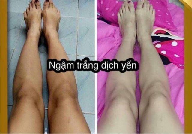 Ngậm trắng dịch yến tươi