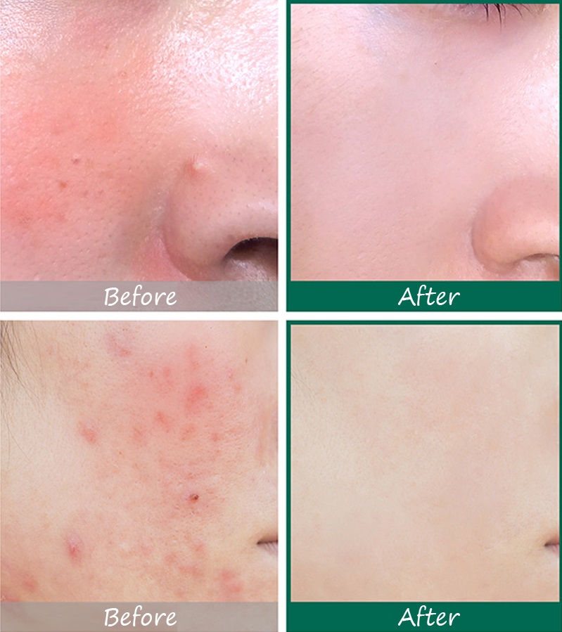 Kem Dưỡng Da Some By Mi AHA-BHA-PHA 30 Days Miracle Cream