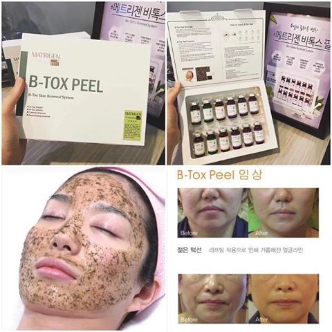 [Hoàn Tiền 8%]Thay Da Sinh Học BTOX PEEL (hộp 12 lọ)