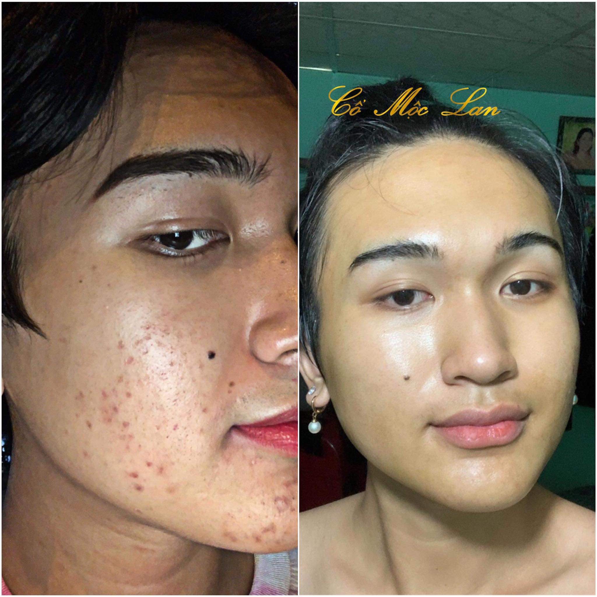 [HCM]Renew skin Dr T Cổ Mộc Lan