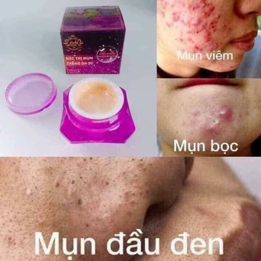 Kem Mụn Trắng Da 2C