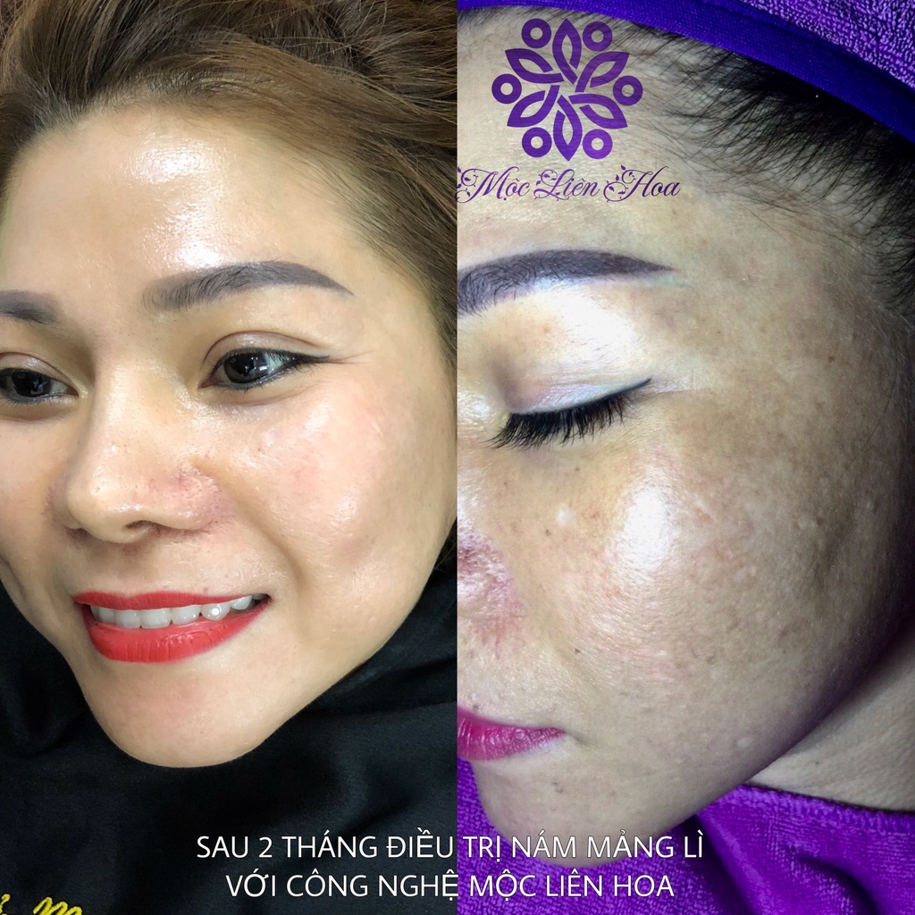 Tailor Made K ULTRA SPOT Kem Quế Hoa (mẫu mới)