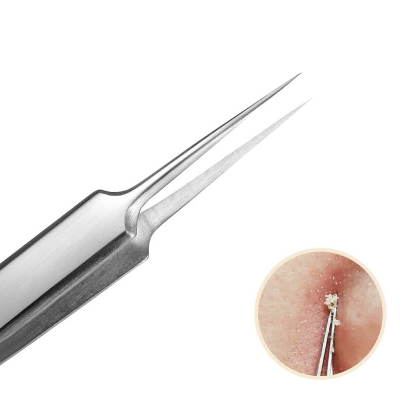 Nhíp gắp mụn bằng thép không gỉ đầu thẳng tiện dụng