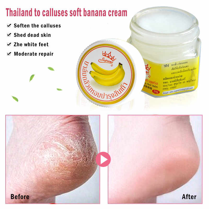 [HCM]KEM CẢI THIỆN NỨT GÓT  CHÂN BANANA