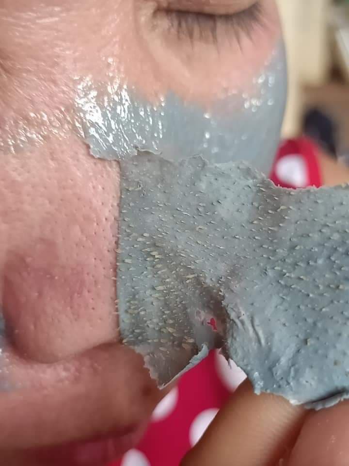 COMBO 2 HỘP GEL HÚT MỤN DR ANCE