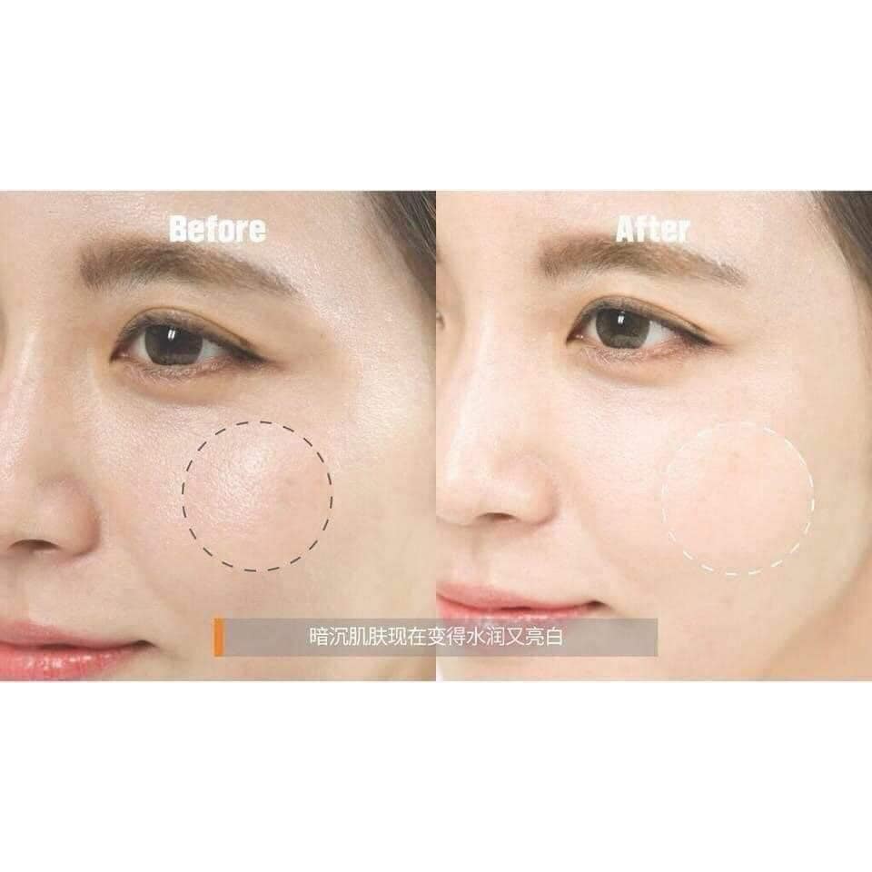 [HCM]Kem dưỡng trắng da DR.JART+ V7 toning light mẫu mới