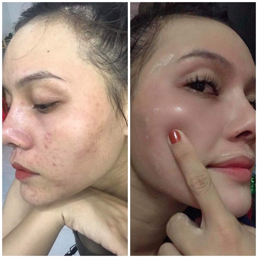SERUM TÁI TẠO THAY DA NHÂN SÂM MQ SKIN