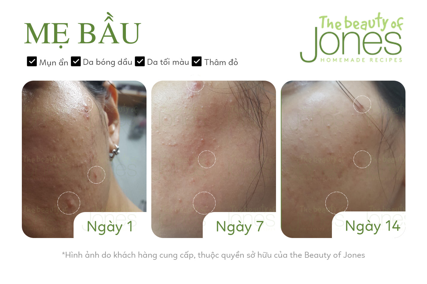 Sữa rửa mặt da mụn nhạy cảm từ trà xanh tảo biển The Beauty of Jones