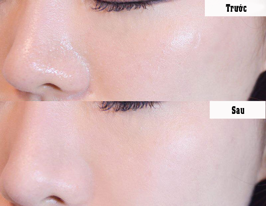 [HCM]Phấn Phủ Kiềm Dầu Catrice All Matt Plus Shine Control Powder