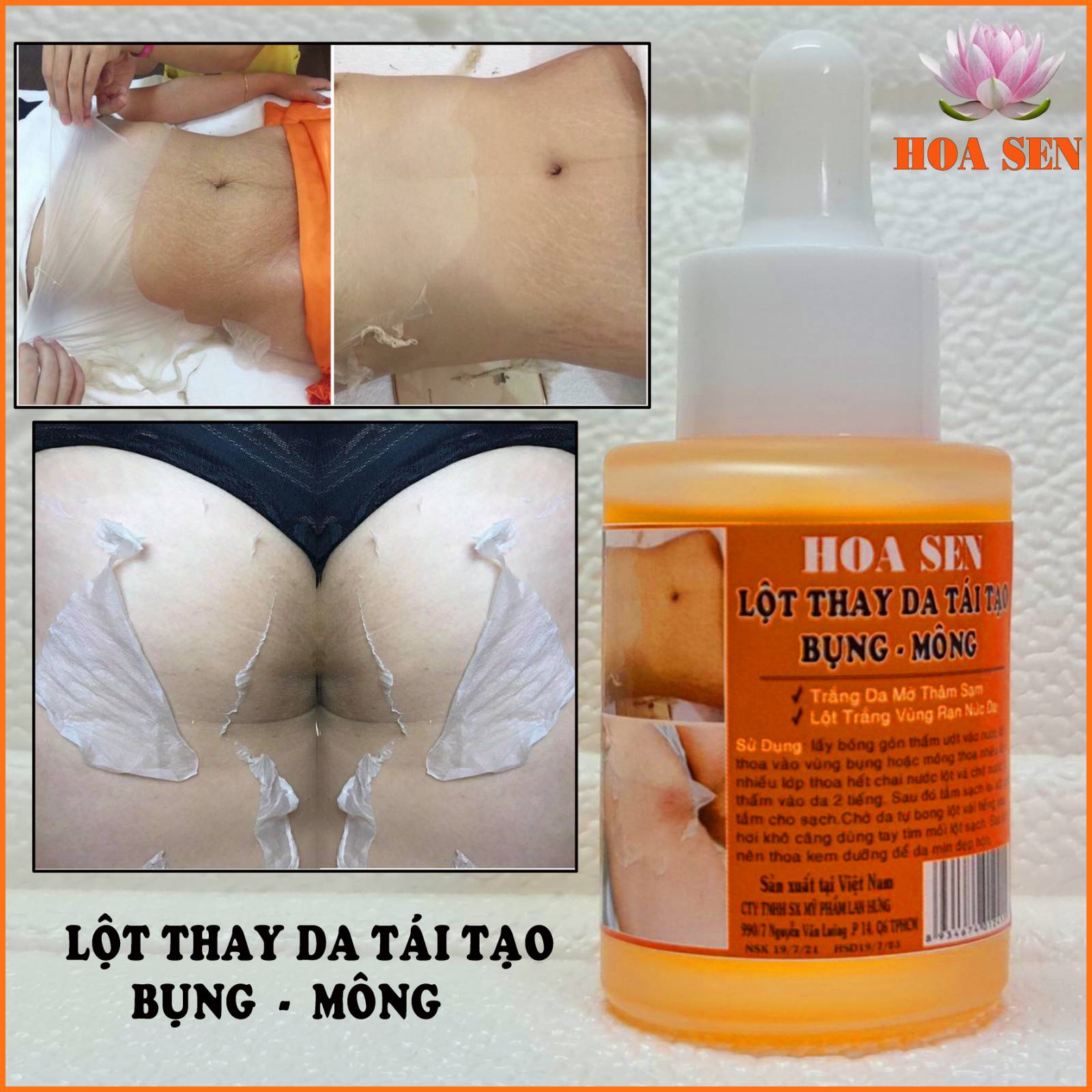 Lột Trắng Da Bụng Mông Bẹn Mờ Rạn Da Thâm Sạm