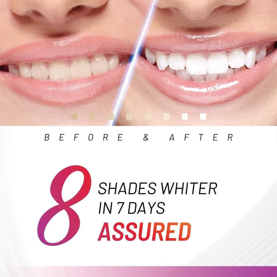 [GIẢM 5% ĐƠN 129K]Bộ Ngậm Trắng Răng White Glo White Accelerator