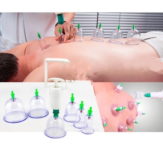 (Click Xem Clip)Bộ Giác Hơi 12 Ống Hút Chân Không,không cần dùng lửa-Đang HOT rần rần
