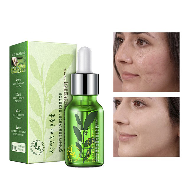 Serum dưỡng da lành mụn trà xanh Rorec 15ml