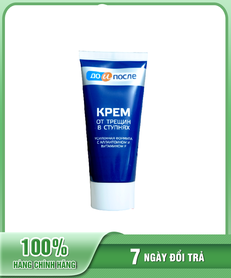 Kem dưỡng nứt nẻ gót chân KPEM 50ml