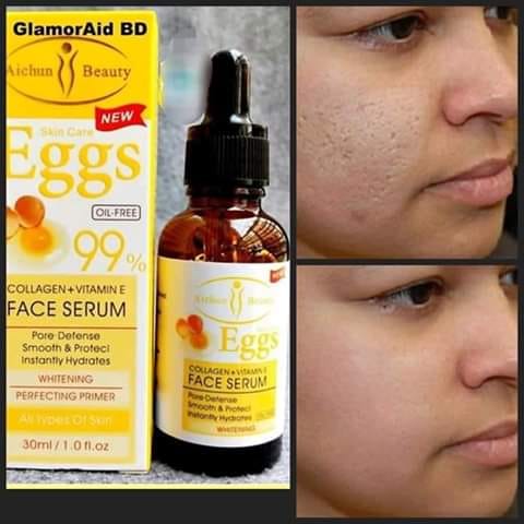 Serum Trứng trắng da, mờ thâm và đốm nâu giảm nếp nhăn da
