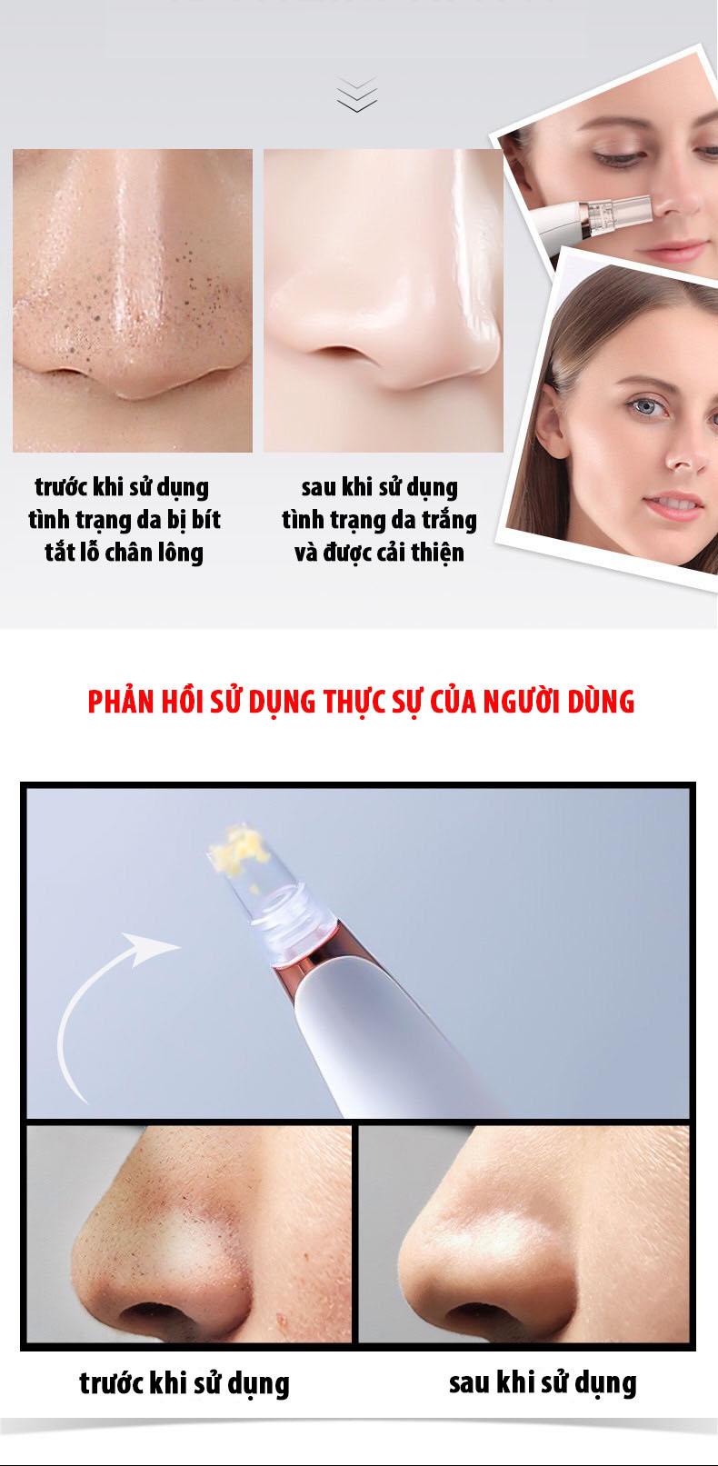 [HCM]Máy Hút Mụn Đầu Đen Bã Nhờn