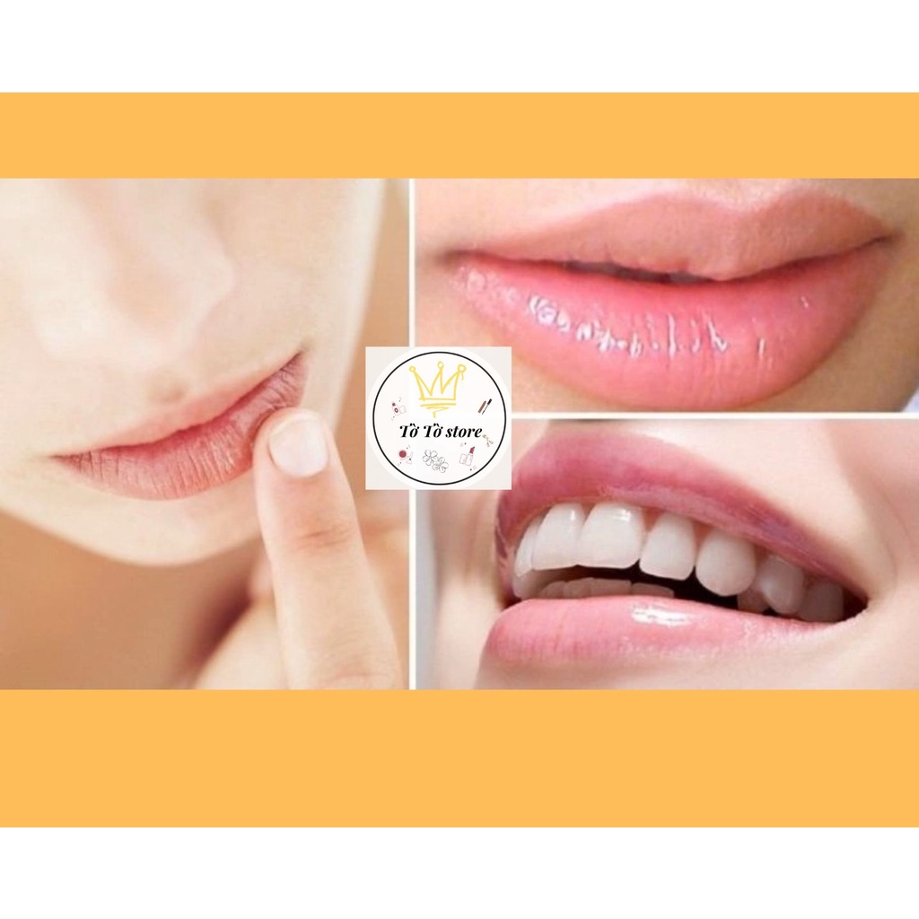 Son Dưỡng Ảm cho Môi Bio Atoderm Lèvres Stick [CÓ ẢNH THẬT]