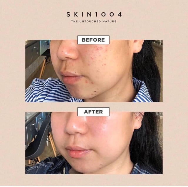 Tinh Chất Dưỡng Rau Má 100Ml