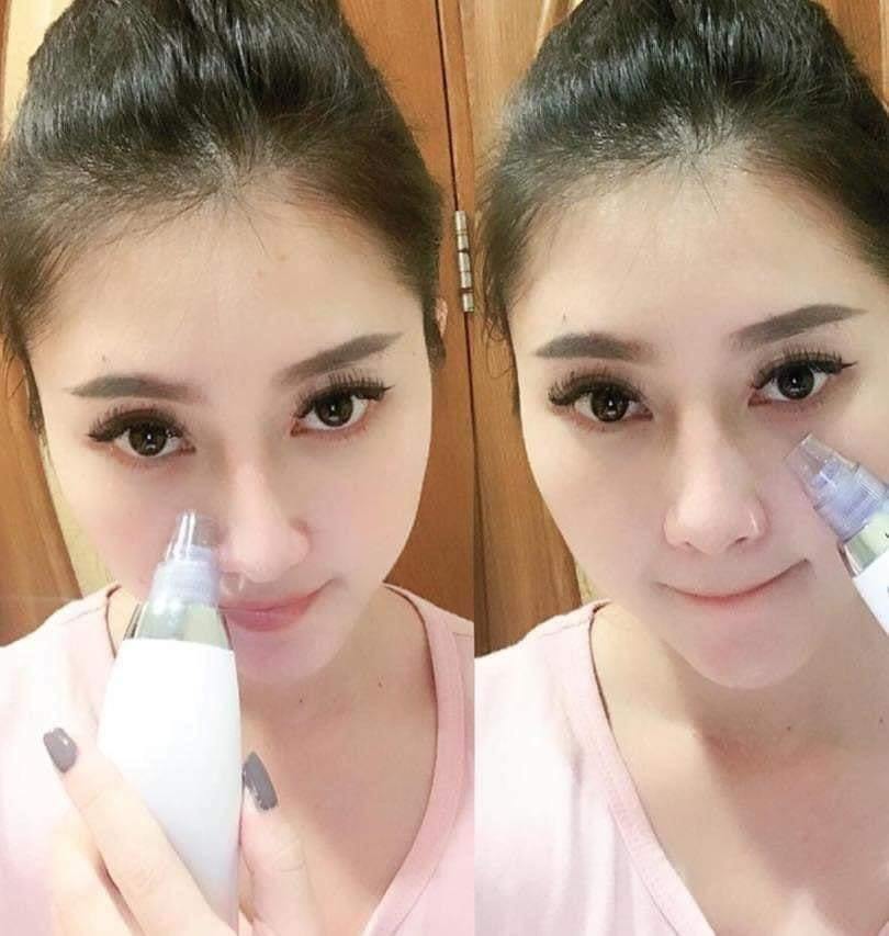 MÁY HÚT MỤN CẦM TAY BLACK HEAD