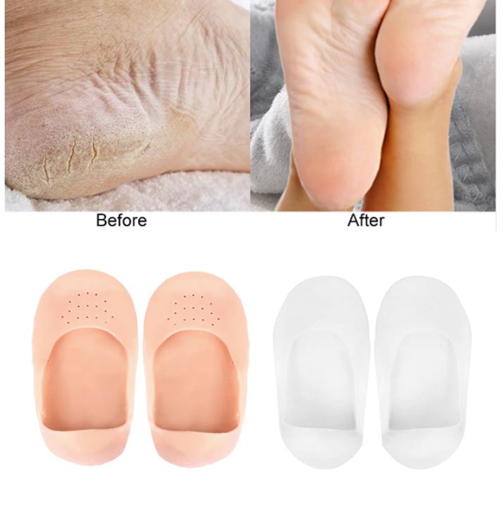 [HCM]Vớ silicon gai gót chân Chống Nứt Gót Chân đau gót chân
