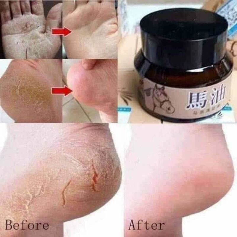 Kem Dầu Ngựa Bôi Nứt Gót Chân (Nội Địa Trung)