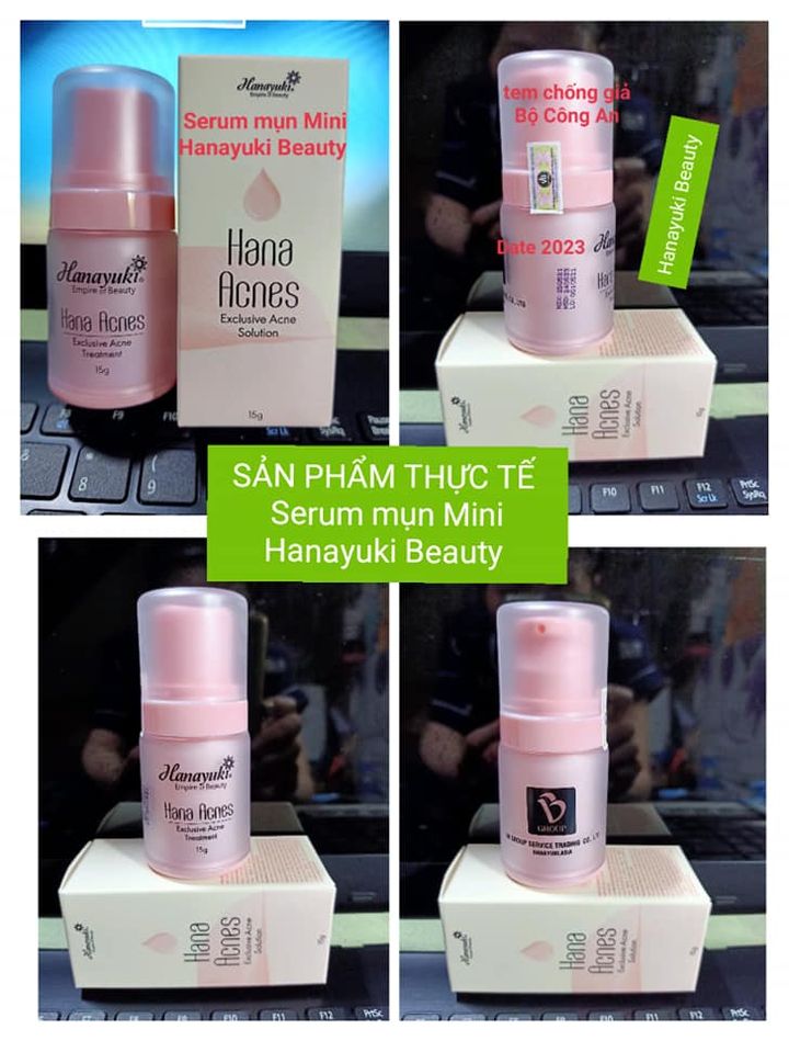[HCM][Chính hãng-Date 2026] SERUM MỤN MINI HANAYUKI 15g -HANA ACNES MINI