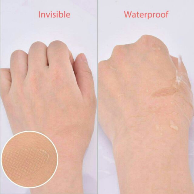 Kích mí lưới không cần keo