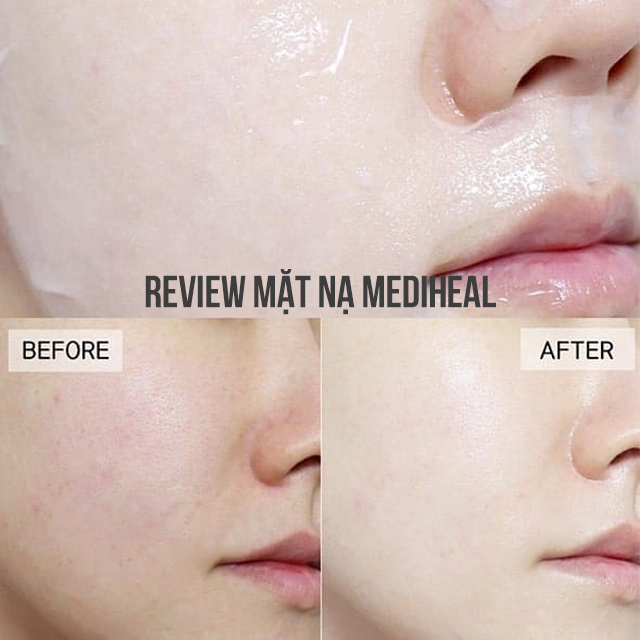 [HCM]Mặt Nạ giấy Mediheal Essential Mask