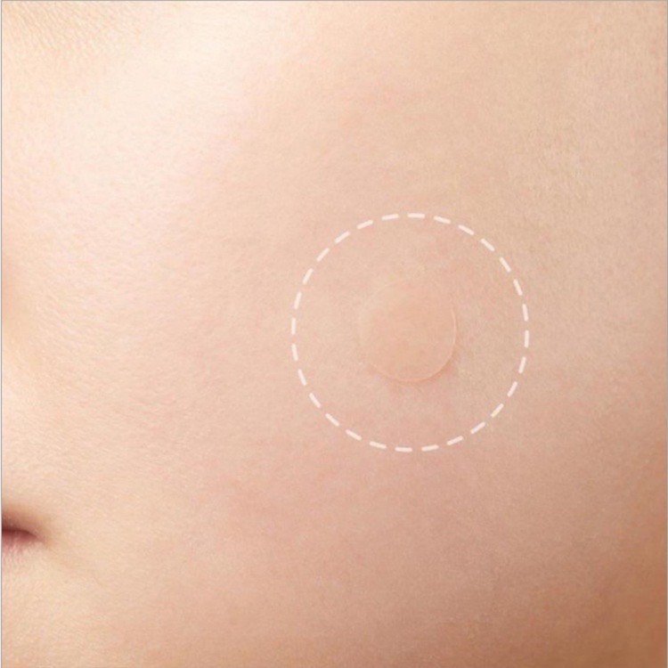 Set 36 miếng dán mụn ACNE PLASTERS, miếng dán che mụn làm xẹp che phủ mụn