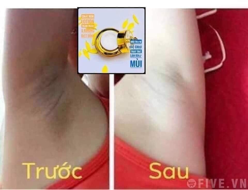 Kem Biho Ladi 5s (Hàng Chính Hãng )