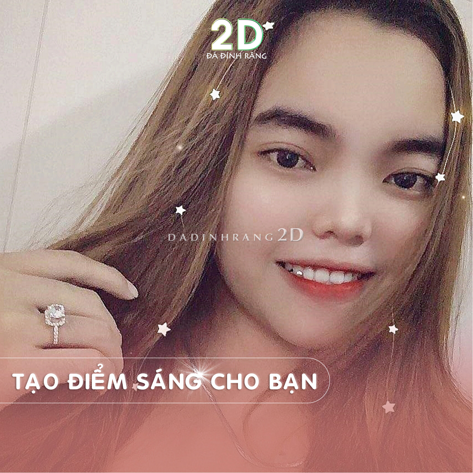 Đá Đính Răng Tại Nhà Đủ Size + Tặng Keo Dán