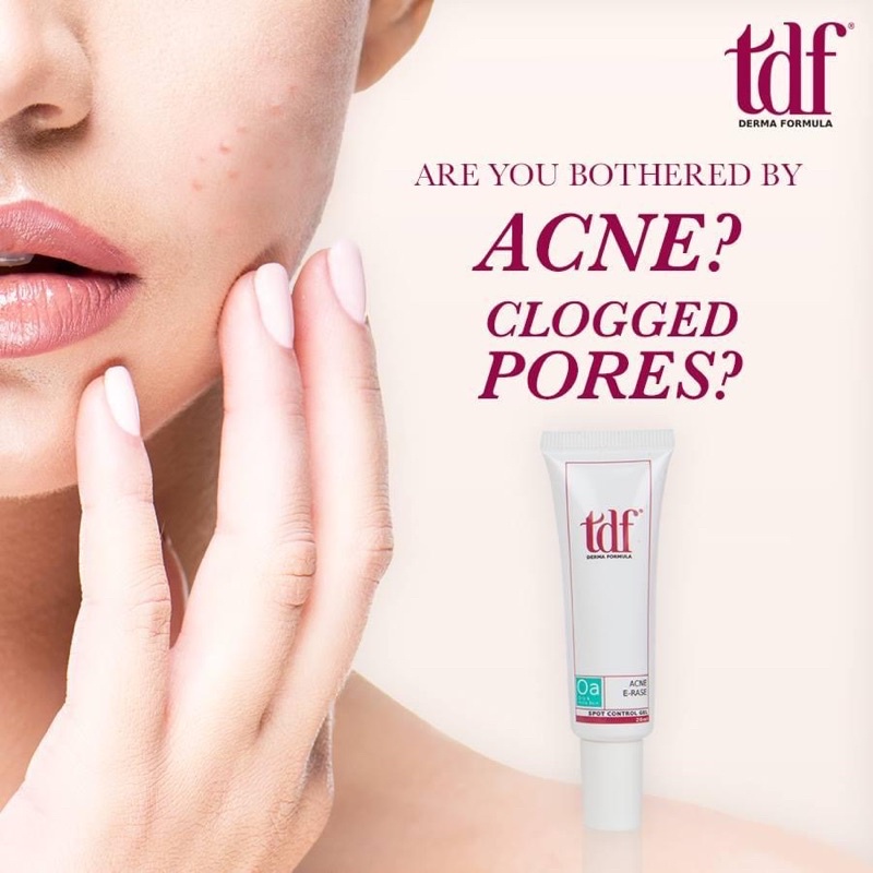 Kem Chấm mụn gom cồi mụ n thần tốc ACNE E RASE TDF