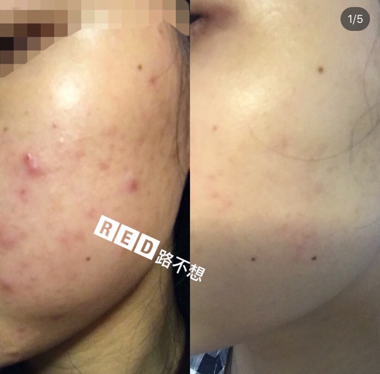 Chấm Mụn Some By Mi Tea Tree 30 Days Miracle Clear Spot Oil 10ml