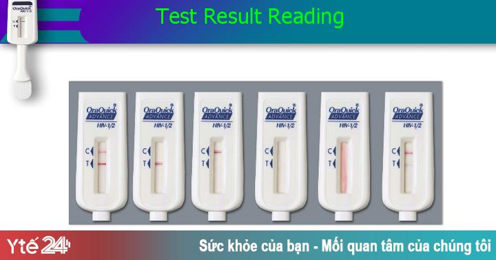 Bộ test HIV tại nhà qua nước bọt Oraquick Hoa Kỳ