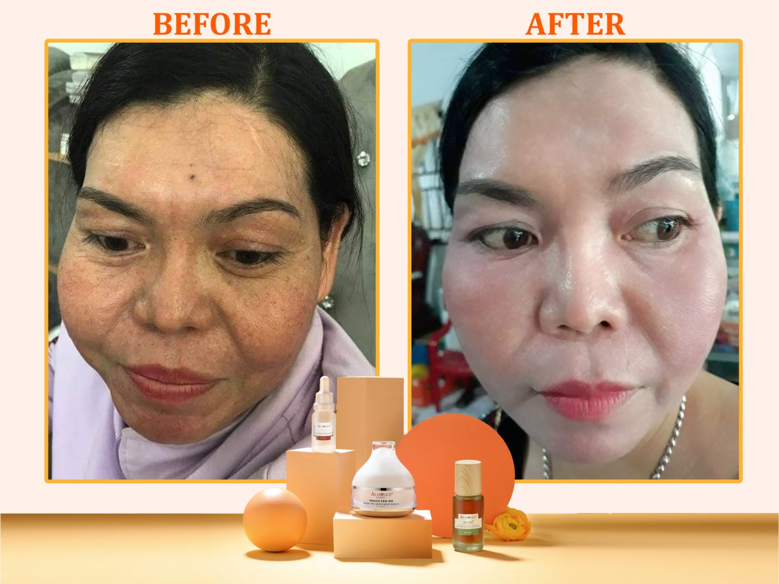 [HCM]KEM TR.I. GIÃN MAO MẠCH - THẠCH SÂM ĐỎ