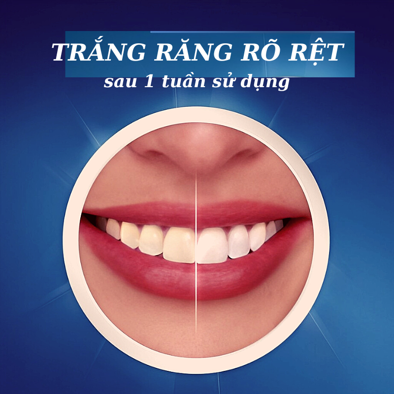 (1 GÓI 7 MIẾNG ) Miếng dán trắng răng chỉ 30 phút 5D TEETH WHITENING STIKER
