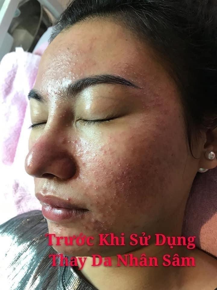THAY DA NHÂN SÂM MQSKIN