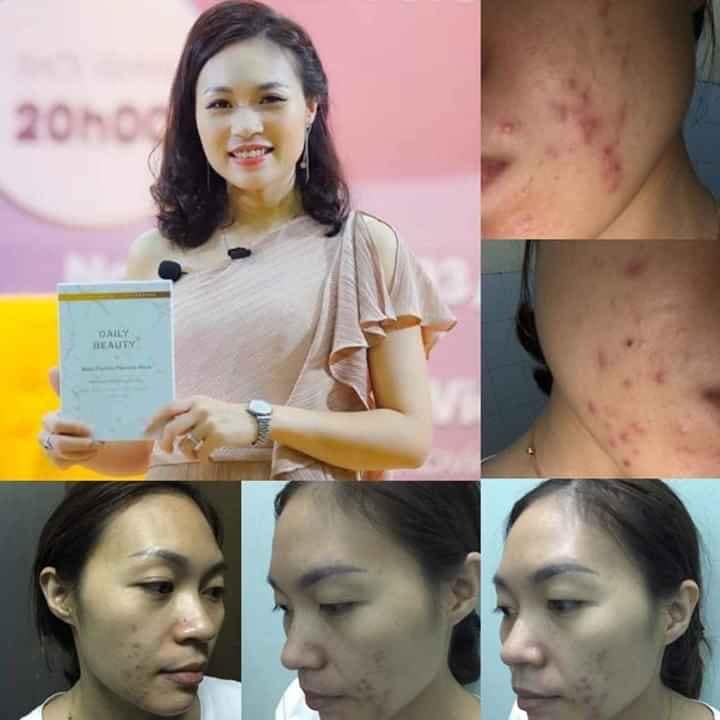 Mặt Nạ Nhau Thai Cừu Multi Peptide Placenta Mask