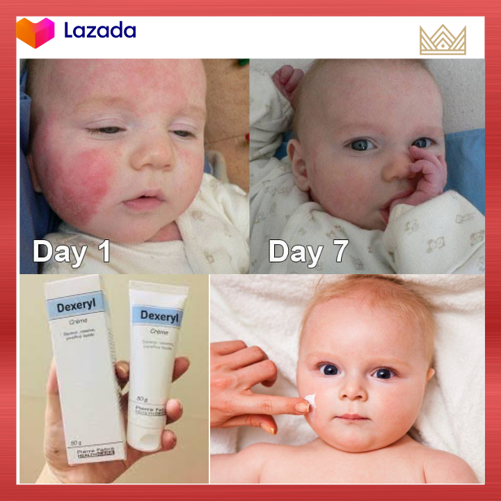 Kem nẻ Pháp DEXERYL GLYCEROL MẪU CŨ 50G