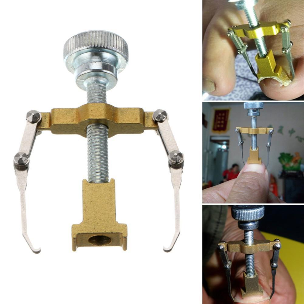 Dụng cụ chữa móng quặp, móng chân chọc thịt đau đớn