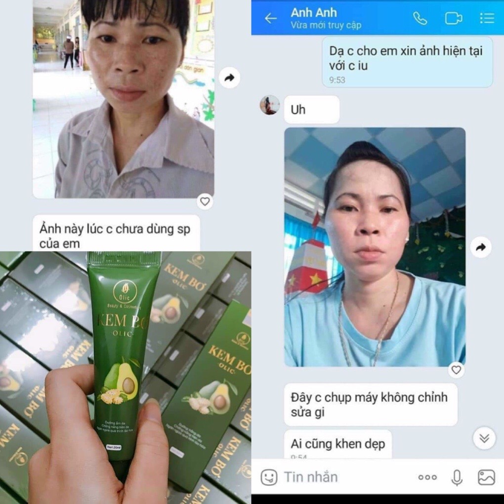 Combo sỉ 3 Kem Bơ Olic chính hãng