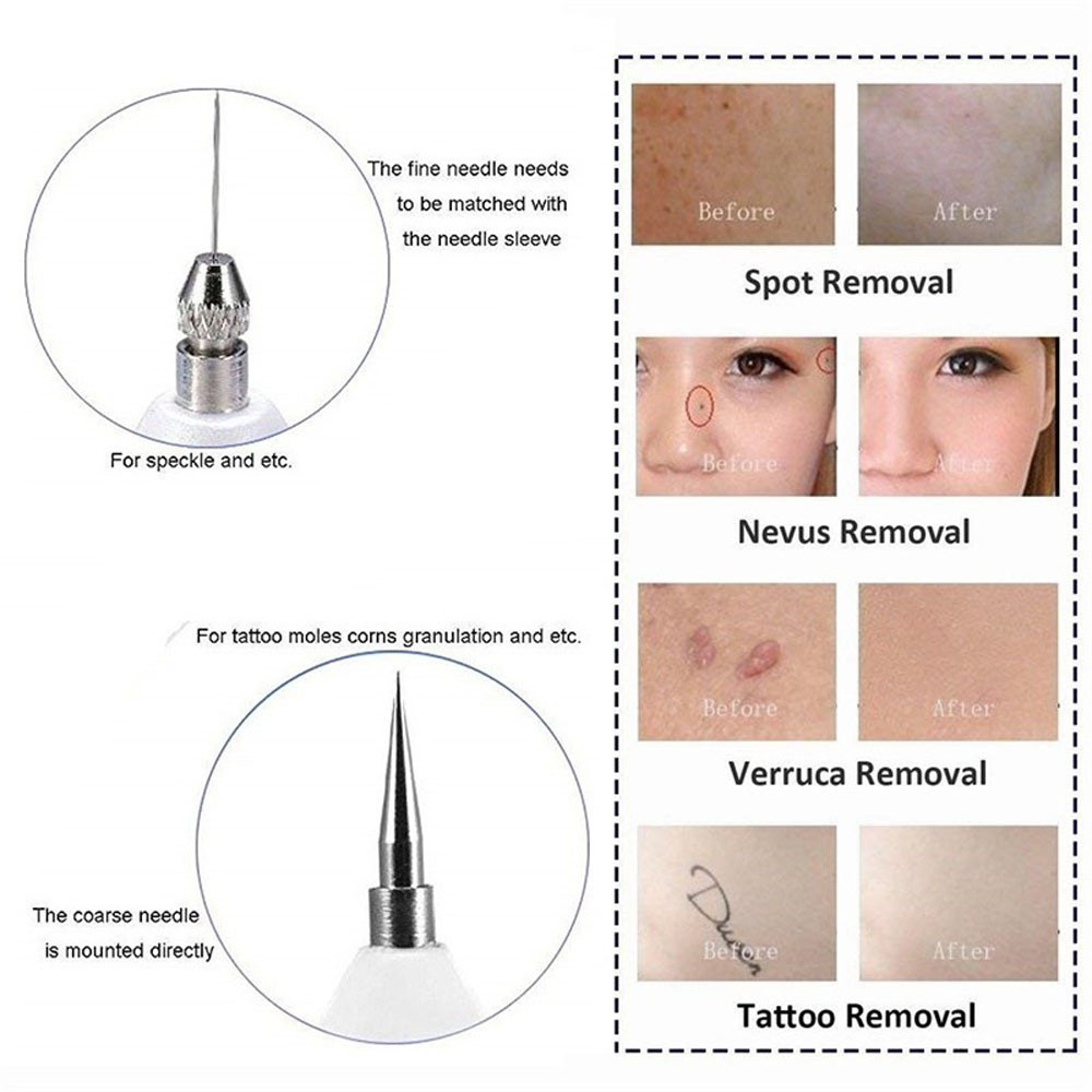 [HCM]Máy Đốt Nốt Ruồi Laser Mụn Đốt mụn thịt dùng trong spa