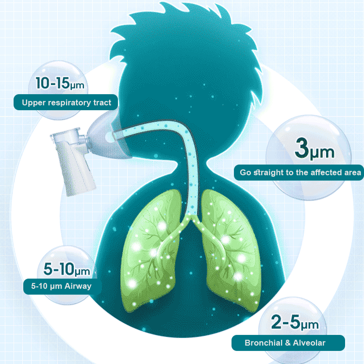 【Limited stock】Ultrasonic micro mesh nebulizer nebulizer portable handheld home