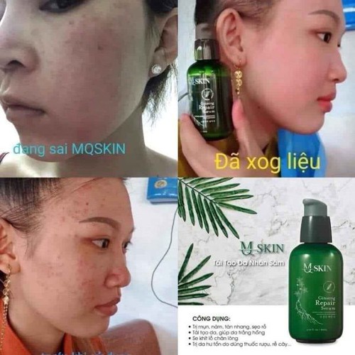 [Chính Hãng]Tái Tạo Da Nhân Sâm MQSKIN 80ml